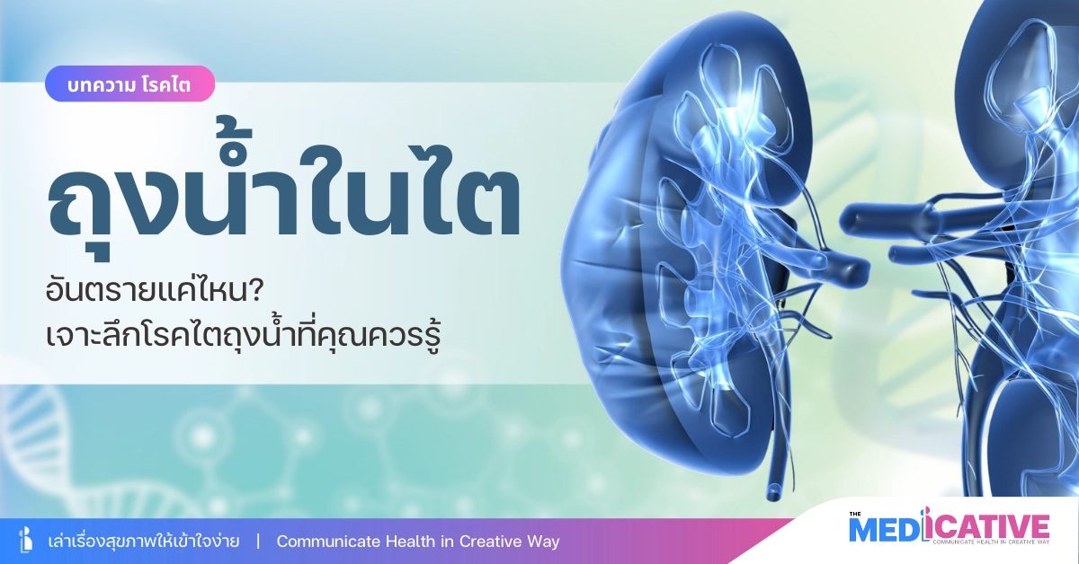 ถุงน้ำในไต อันตรายแค่ไหน? เจาะลึกโรคไตถุงน้ำ (Polycystic Kidney Disease)