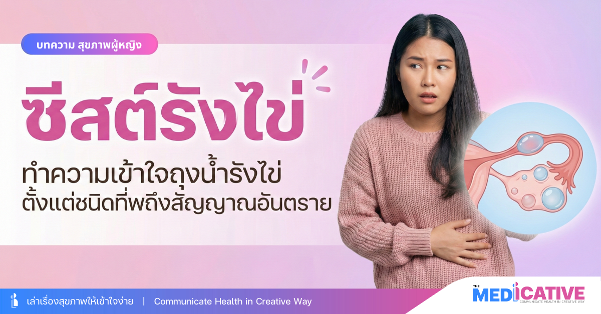 ซีสต์รังไข่