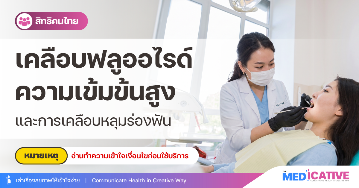 เคลือบฟลูออไรด์ความเข้มข้นสูงและการเคลือบหลุมร่องฟัน